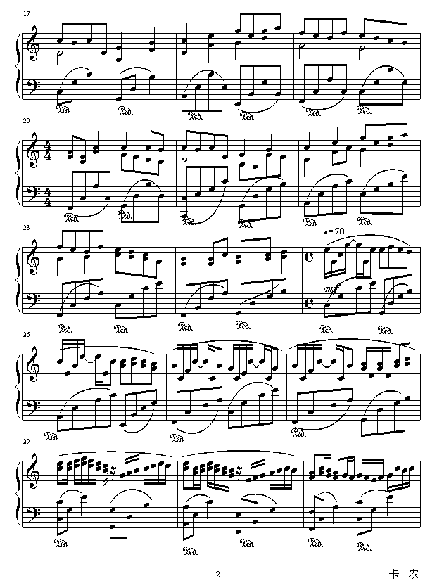 Canon Mix Vision2